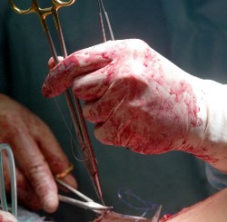operation_chirurg